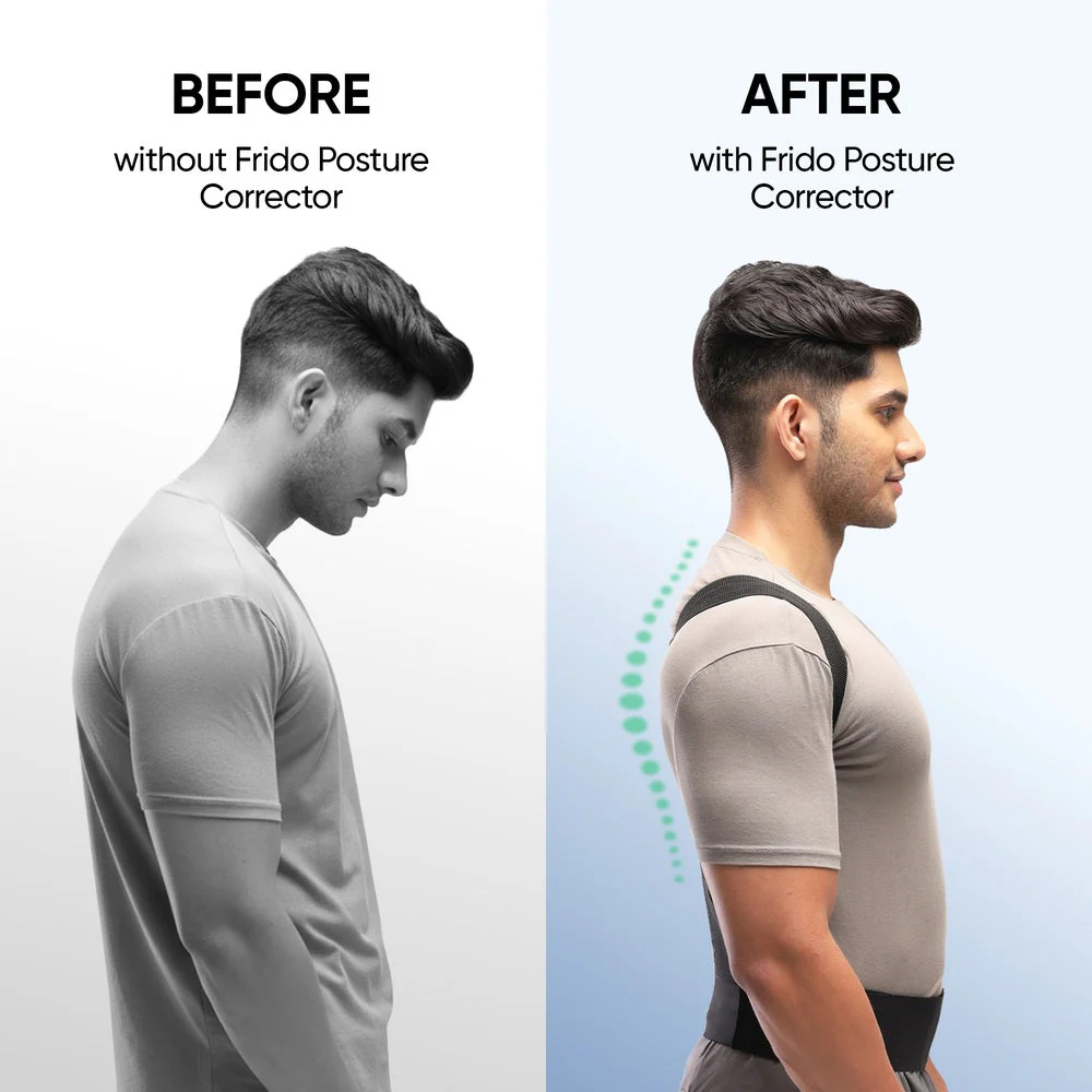 Frido Orthotics Posture Corrector